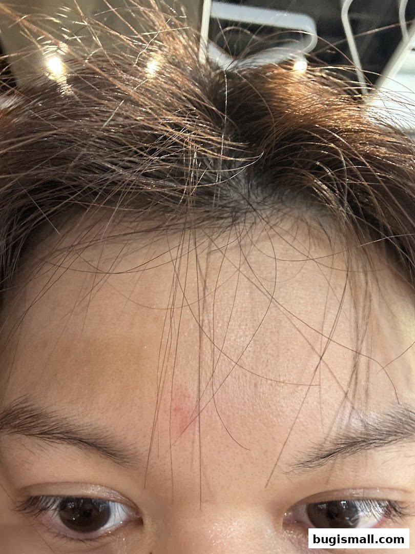 Close-up of a person's forehead with fine hairs and a small red mark.