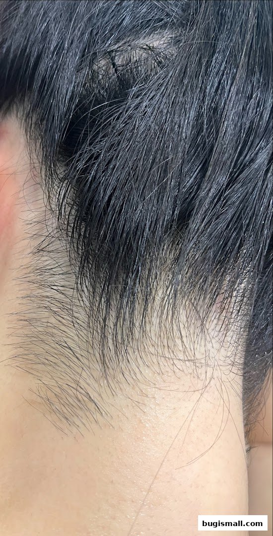Close-up of a person's dark hair and skin, showing fine hairs.